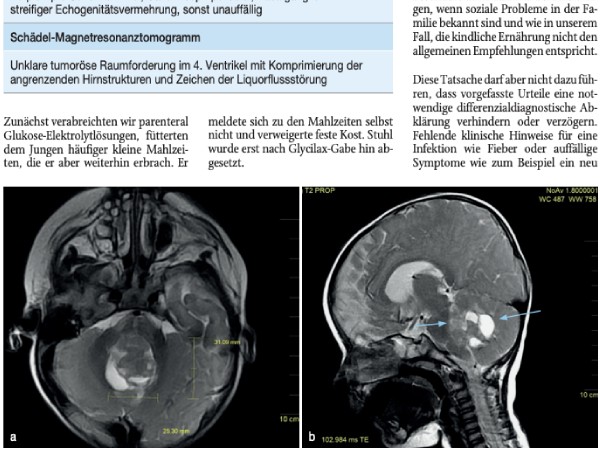 Akute Gedeihstörung – wirklich nur ein gastroenterologisches oder Pflegeproblem?