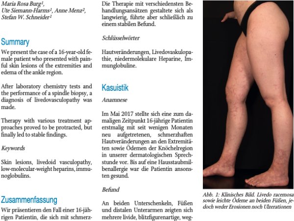 Seltene Erkrankungen: Livedovaskulopathie – komplexe Diagnose, komplexe Therapie