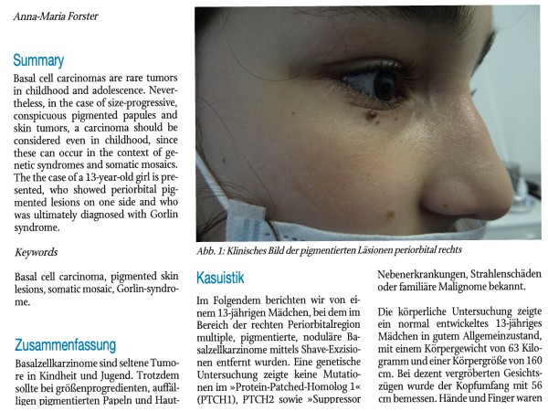 Somatisches Mosaik bei einem 13-jährigen Mädchen