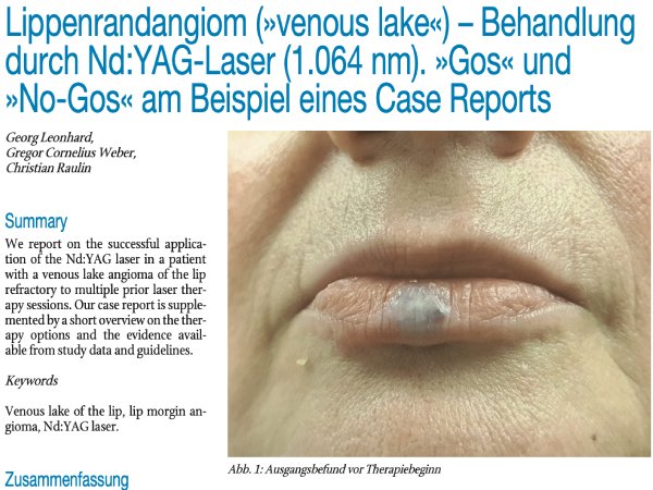 Lippenrandangiom (»venous lake«) – Behandlung durch Nd:YAG-Laser (1.064 nm). »Gos« und »No-Gos« am Beispiel eines Case Reports