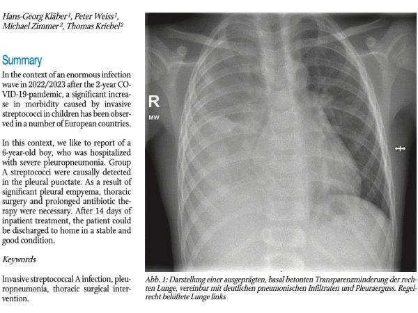 Schwere Pleuropneumoniebei einem 6-jährigen Jungen durch Streptococcus pyogenes