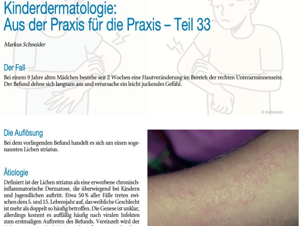 Kinderdermatologie: Aus der Praxis für die Praxis – Teil 33