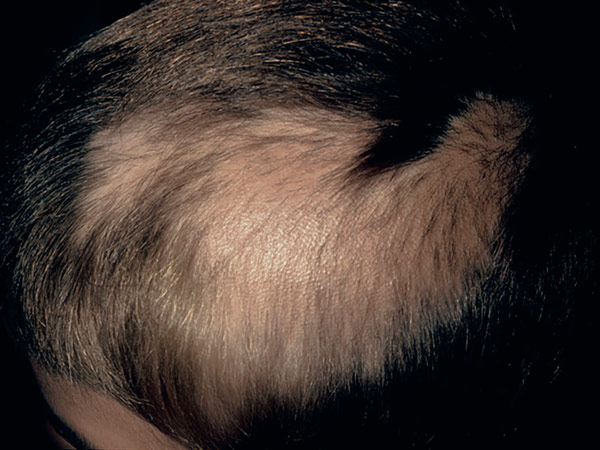 Kinderdermatologie: Aus der Praxis für die Praxis – Teil 34