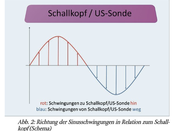 Farbkodierte M-Mode-und Duplex-Sonografie der schwingenden Stimmlippen bei Phonation