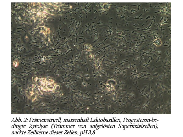 Die Phasenkontrastmikroskopie. Technik und »Lesen« des Nativpräparats in der Gynäkologie