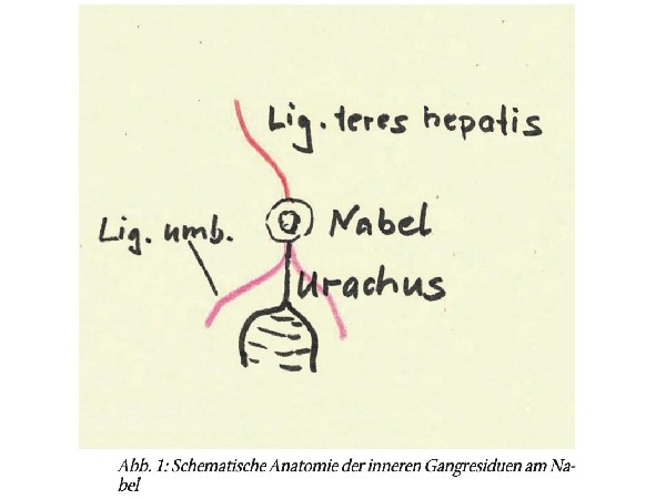 Nabel- und epigastrische Hernien im Kindesalter – klinische Praxis