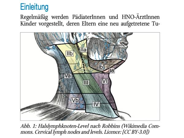 Differenzialdiagnose und rationale Diagnostik bei Kindern mit zervikalen Raumforderungen