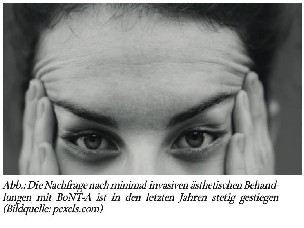 Botulinum Typ A in der ästhetischen Medizin bei Multipler Sklerose
