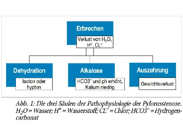 Pylorusstenose. Klinik, Labor, Behandlung – was Sie schon immer nachschlagen wollten!