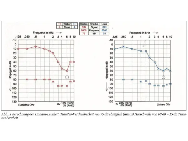 Tinnitus und das Leiden am Tinnitus. Eine integrierte Darstellung HNO-ärztlicher, psychodynamischer und kognitiv verhaltenstherapeutischer Ansätze