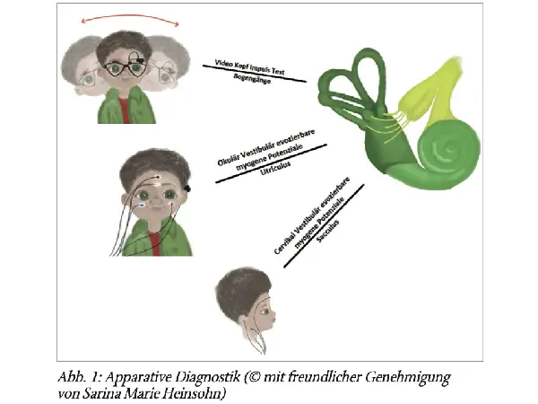 Pädiatrische HNO: Vestibuläres Säuglings-Screening