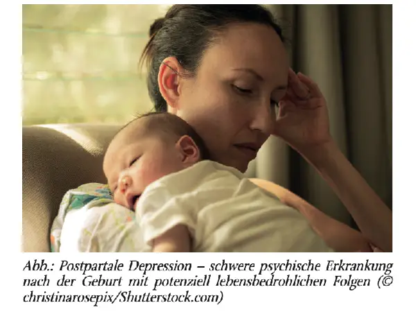 Psychiatrische Probleme in der Schwangerschaft und postpartal