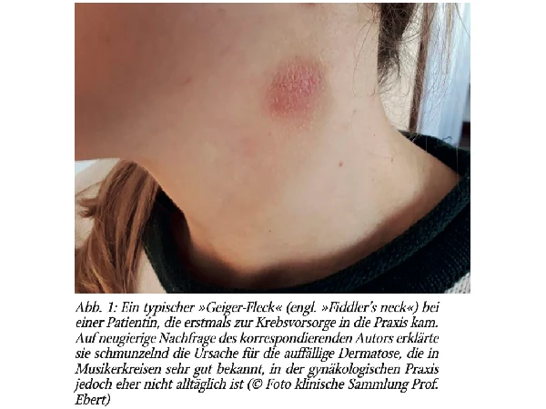 Gynäkologische Blickdiagnosen. »Fiddler’s neck« in der gynäkologischen Praxis