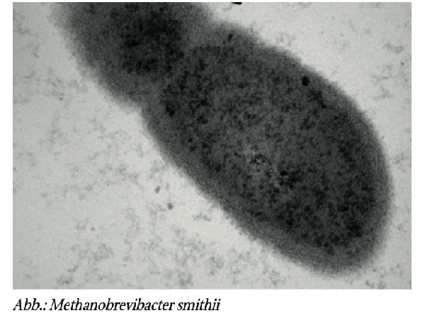 Präsenz und Bedeutung von Archaeen im vaginalen Mikrobiom