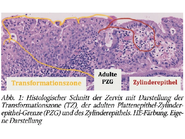 Die Transformationszone der Zervix – Embryologie, Entwicklung über die Lebensphasen und klinische Bedeutung